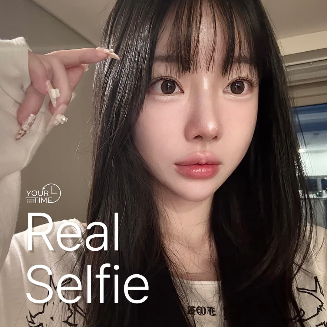 유어타임성형외과 리얼셀피 — 코재수술