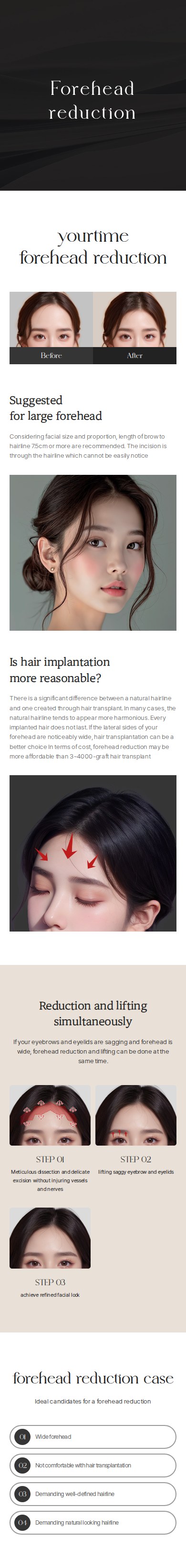 Forehead Reduction