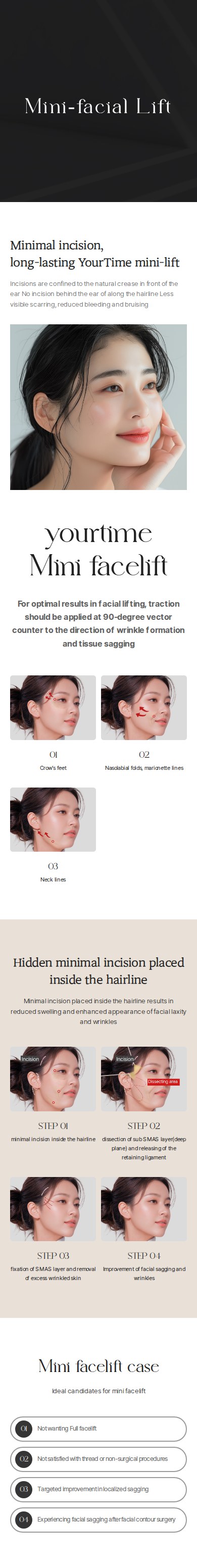 Mini-facial Lift