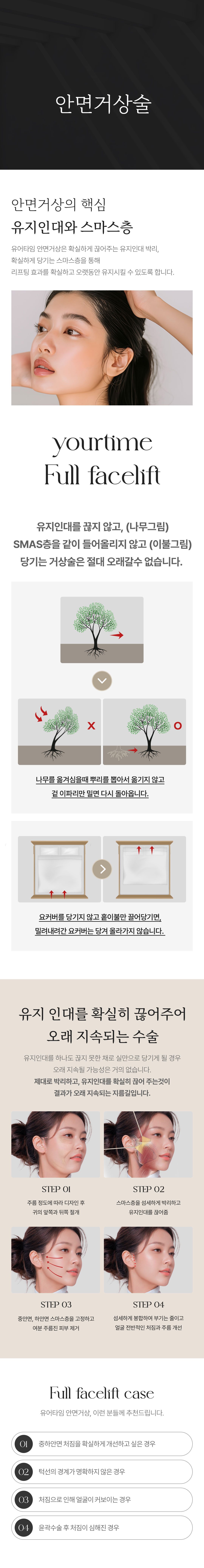 안면거상술 안내